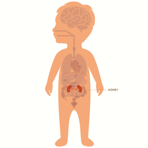 Kidney Tumors In Children And Teens Together