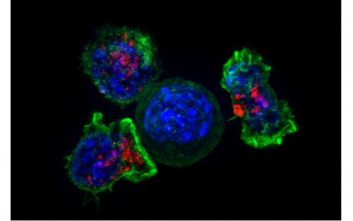 Zdjęcie w wysokiej rozdzielczości przedstawiające skupisko limfocytów cytotoksycznych T widocznych w kolorach czerwonym i zielonym, które otaczają owalną komórkę nowotworową w kolorze niebieskim.