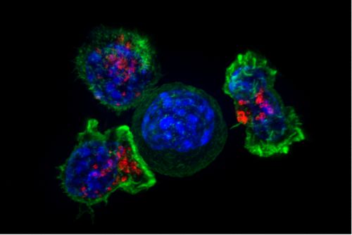 Super resolution photo of a cluster of killer T cells that are red and green surrounding a cancer cell which is round and blue.