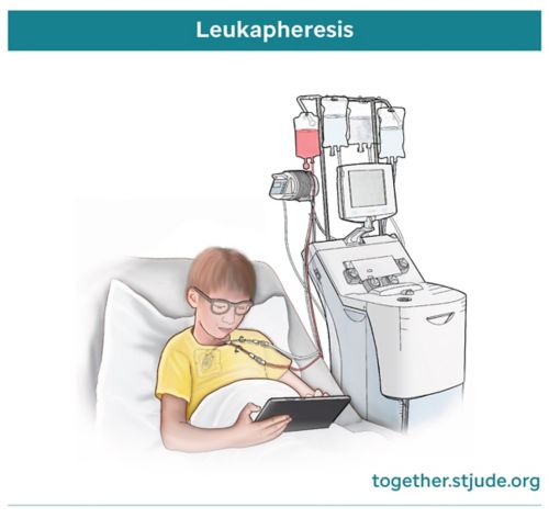 Medical illustration of male child in hospital bed receiving leukapheresis through IV 