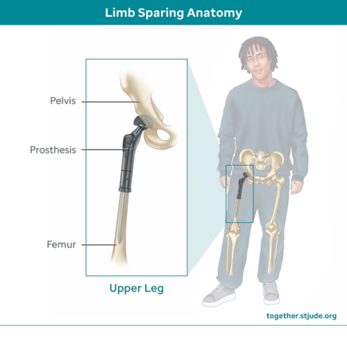 Limb sparing anatomy