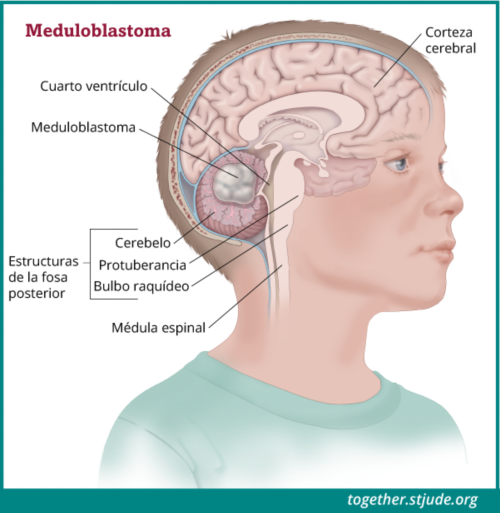 La imagen muestra las estructuras de la fosa posterior del cerebro dentro de la cabeza de un niño.