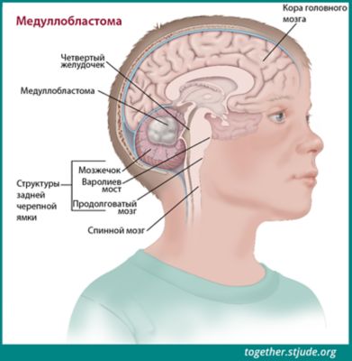 Где Мозжечок У Человека Фото