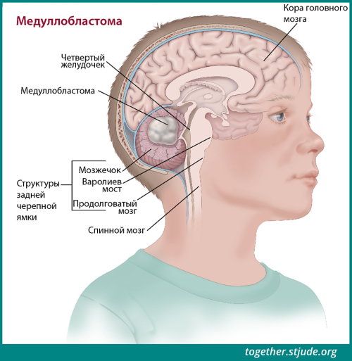Иллюстрация, на которой показаны структуры задней черепной ямки в голове ребенка