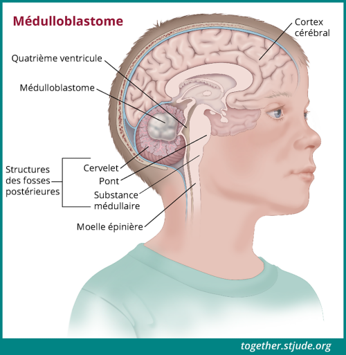 Illustration montrant les structures de la fosse postérieure du cerveau à l'intérieur de la tête d'un enfant