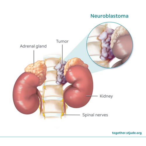 Neuroblastoma tumor, kidneys, and adrenal glands