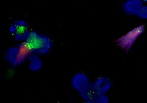 Microscopic image of neutrophils