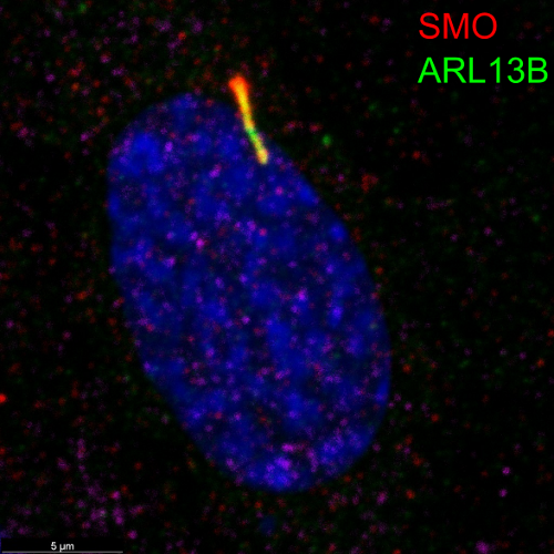Primary cilium shown using flourescently labeled proteins