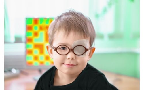 Child wearing eye patch underneath glasses