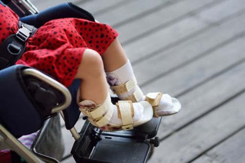 Child in wheelchair wearing orthotics gear.