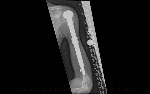 X-ray image of an arm