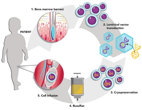 graphic depicting the bone marrow donation process