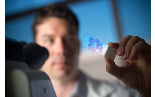 Pathologist holds up microscope slide. 