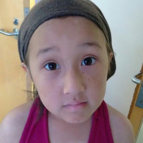 Closeup of patient looking at camera wearing a gray hat