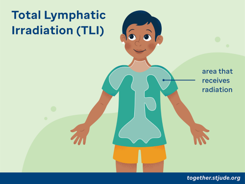 Diagrama de la irradiación linfática total (TLI)