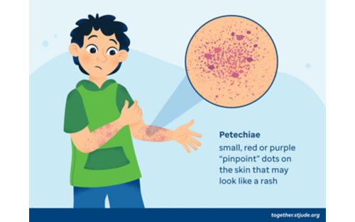 Illustration of a boy with petechiae, rash-like dots on the skin due to bleeding, on his arms.