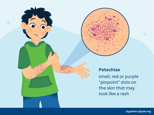 Petechiae illustration