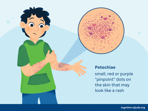 Petechiae are small, red or purple "pinpoint" dots on the skin that may look like a rash