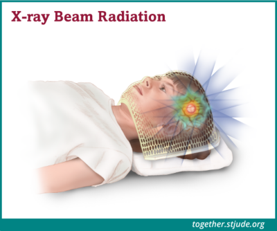 photo beam radiation illustration together?fmt=png
