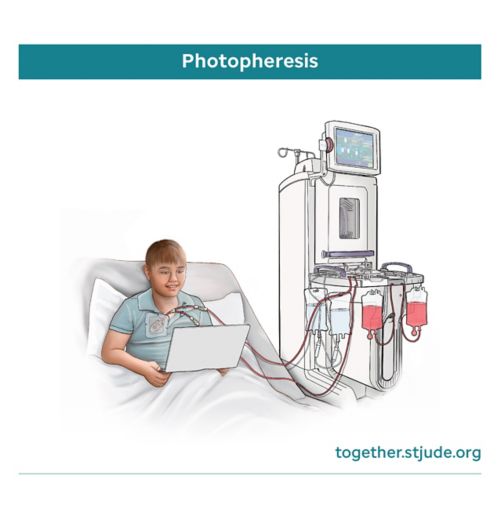 Medical illustration of male child in hospital bed undergoing photopheresis treatment.