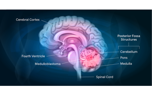 posterior fossa