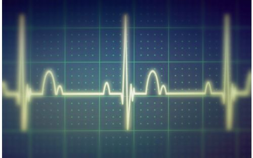 Closeup of heart monitor screen