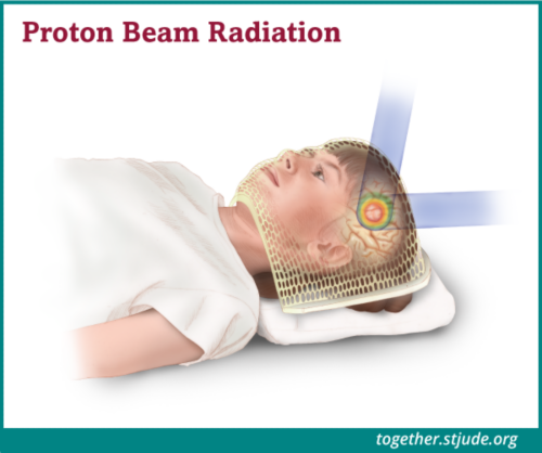 What is proton therapy? Proton therapy is a type of radiation therapy that uses protons as its energy source. The amount of energy and how deep it goes into the tumor can be tailored to match each tumor’s size and shape. In proton radiation the beam can stop at the tumor site. This allows doctors to aim high doses of radiation at tumors and minimize damage to nearby healthy cells.