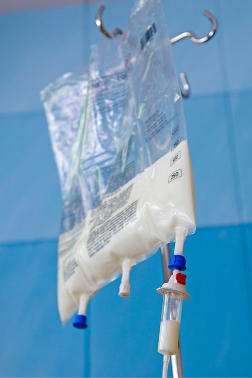 A TPN bag made of clear plastic and filled with white fluid