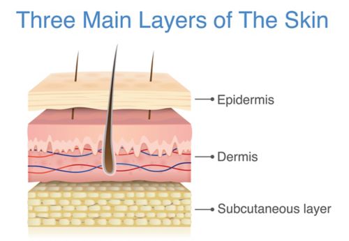 Illustration montrant une coupe transversale des couches de la peau sur laquelle l'épiderme, le derme et la couche sous-cutanée sont identifiés.