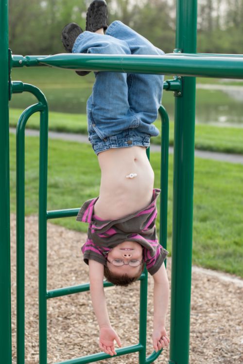 A young patient hanging from monkey bars with a feeding tube visible.