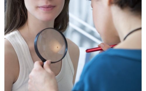 Doctor checks mole on woman's skin