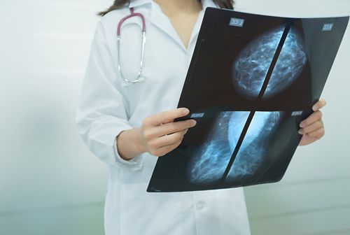 doctor holding mammography