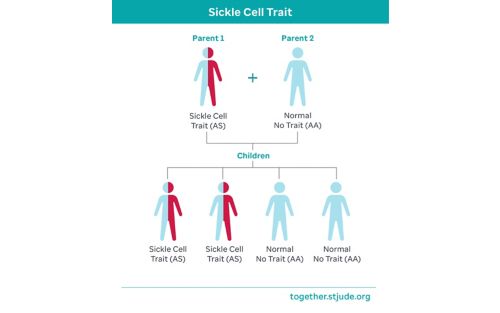 sickle cell trait medical illustration