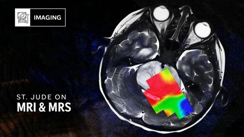 image for St. Jude On article on MRIs