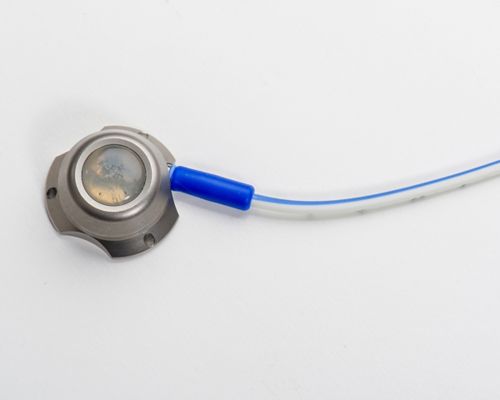 Picture of a single-lumen tunneled subcutaneous port often used in pediatric cancer treatment.