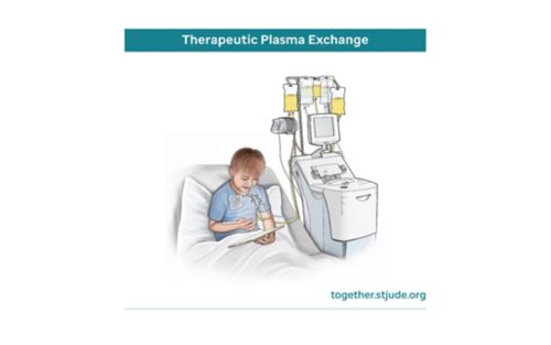 Medical illustration of child undergoing therapeutic plasma exchange in hospital bed