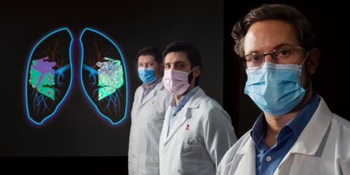 Three men in white coats and masks with an image of the lungs