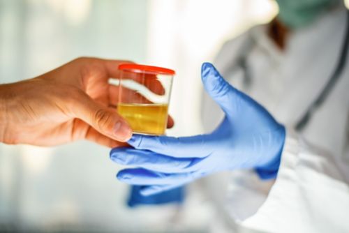 Man handing container with urine sample to a doctor