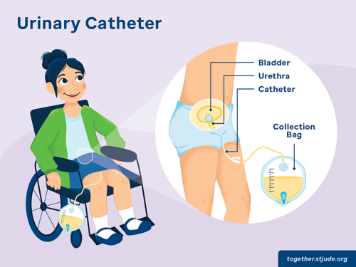 illustration of female child in wheelchair with urinary catheter showing the different parts of the catheter including the bladder, urethra, catheter, and collection baf