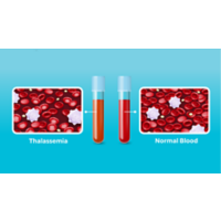 Thalassemia illustration