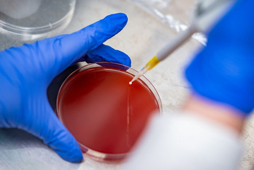 Petri dish
