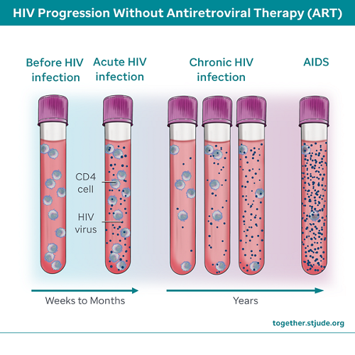 HIV انفیکشن سے پہلے خون کی شیشیاں دکھائی گئی ہیں، پھر دائمی HIV انفیکشن اور ایڈز