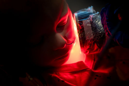 A patient receives red light therapy to prevent oral mucositis
