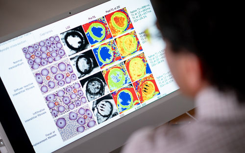 Profile of someone looking at images of scans on a computer screen 