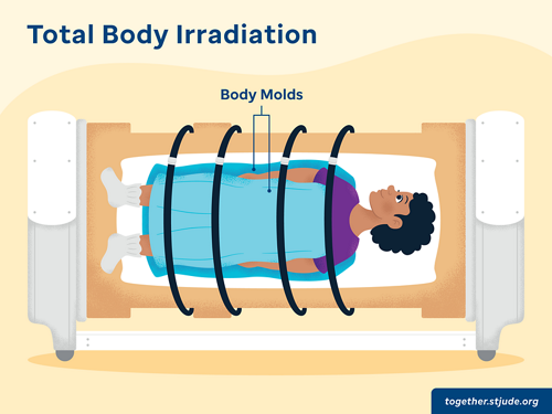 Body mold