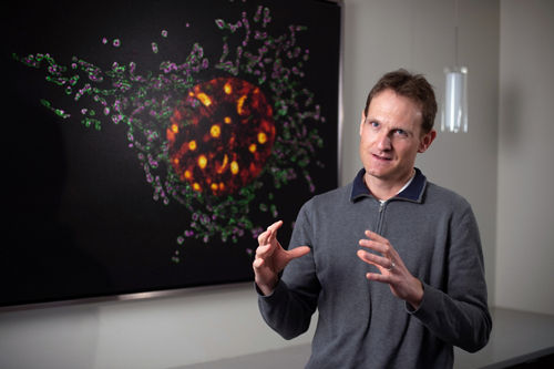 Clues to precision treatments for a tough childhood leukemia