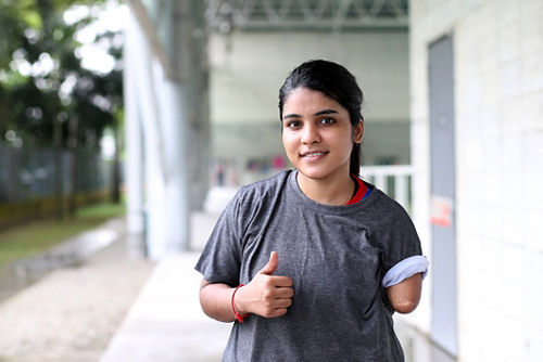 A female teen with an amputated left limb