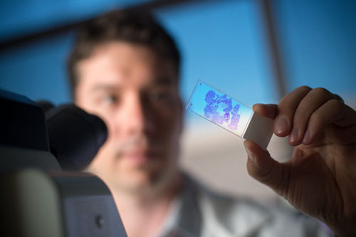 Un patólogo y un investigador de cáncer pediátrico observan un corte histológico de células de un paciente con cáncer infantil. 