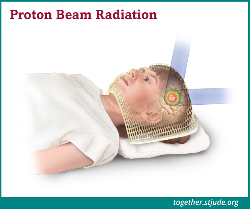 Proton beam therapy