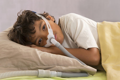 Постоянное положительное давление в дыхательных путях (CPAP) является распространенным методом лечения обструктивного апноэ сна.